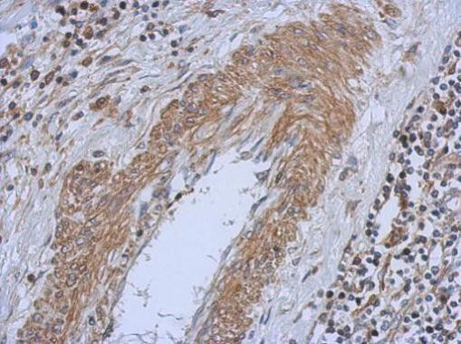 PI4KA Antibody in Immunohistochemistry (Paraffin) (IHC (P))