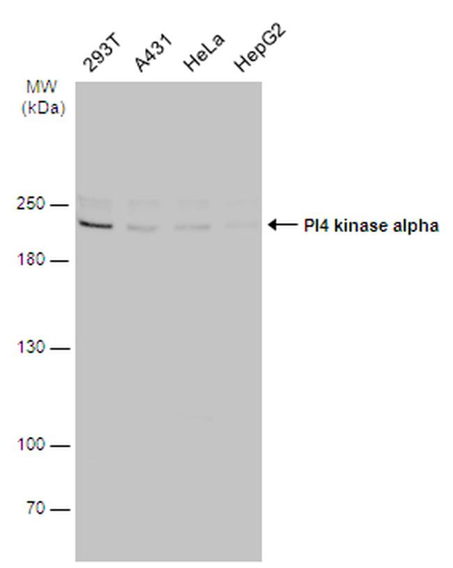 PI4KA Antibody in Western Blot (WB)