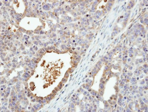 MEK6 Antibody in Immunohistochemistry (Paraffin) (IHC (P))