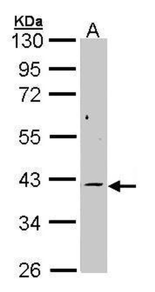 MEK6 Antibody in Western Blot (WB)