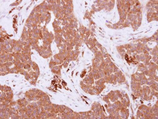 FRK Antibody in Immunohistochemistry (Paraffin) (IHC (P))