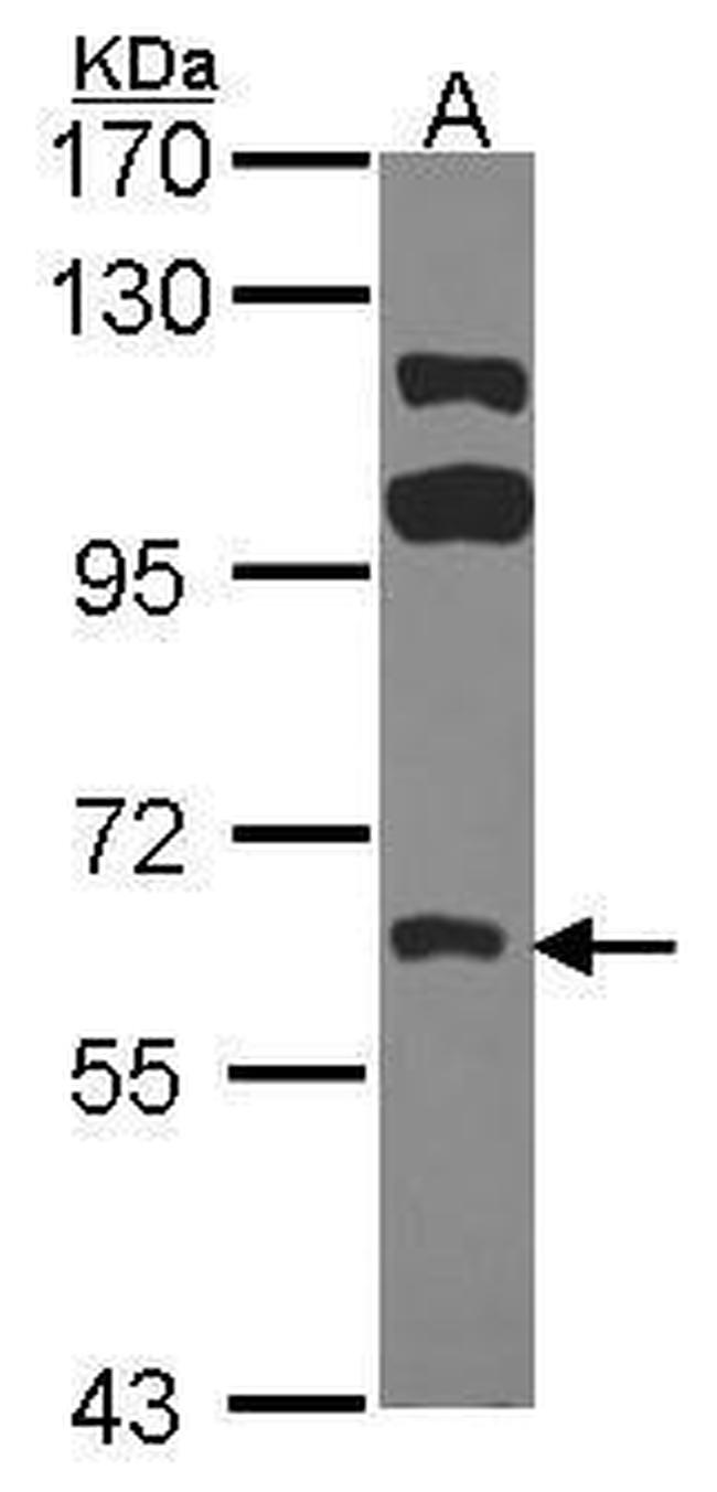 FRK Antibody in Western Blot (WB)