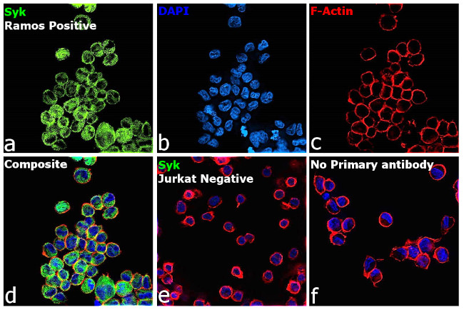 Syk Antibody in Immunocytochemistry (ICC/IF)