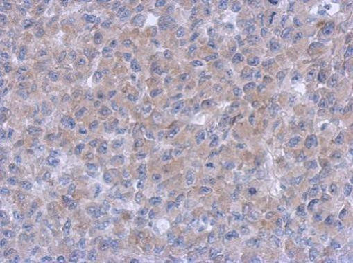 Syk Antibody in Immunohistochemistry (Paraffin) (IHC (P))