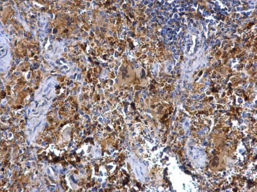 Syk Antibody in Immunohistochemistry (Paraffin) (IHC (P))