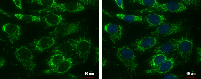 Adenylate Kinase 4 Antibody in Immunocytochemistry (ICC/IF)