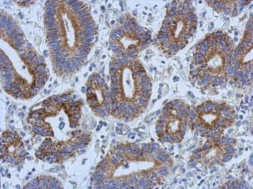 Adenylate Kinase 4 Antibody in Immunohistochemistry (Paraffin) (IHC (P))