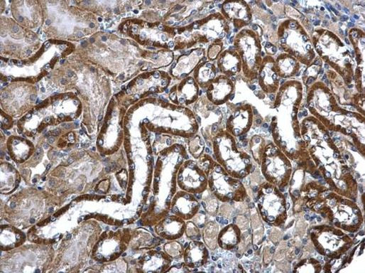 MEK3 Antibody in Immunohistochemistry (Paraffin) (IHC (P))