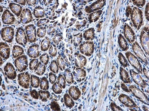 MEK3 Antibody in Immunohistochemistry (Paraffin) (IHC (P))