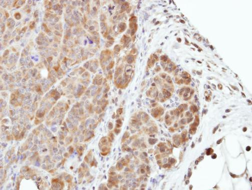 MEK3 Antibody in Immunohistochemistry (Paraffin) (IHC (P))