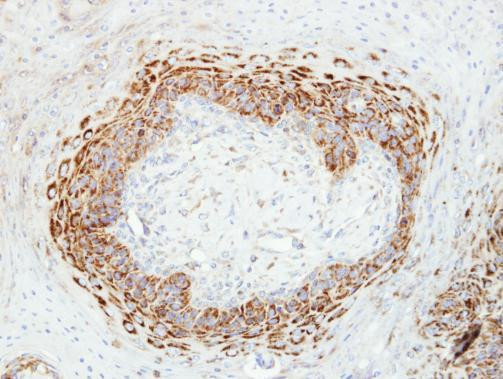 CKMT2 Antibody in Immunohistochemistry (Paraffin) (IHC (P))