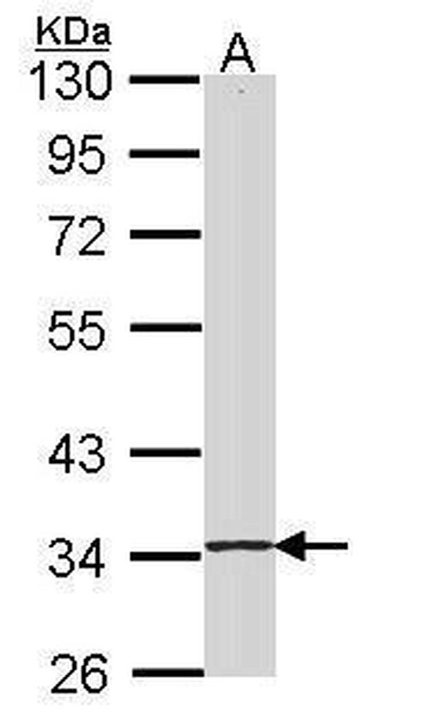 SKAP55 Antibody in Western Blot (WB)