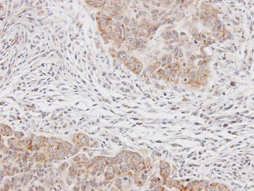 p70 S6 Kinase Antibody in Immunohistochemistry (Paraffin) (IHC (P))