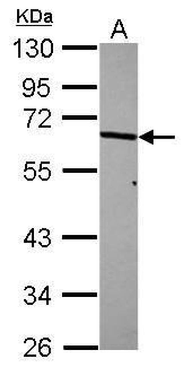 p70 S6 Kinase Antibody in Western Blot (WB)