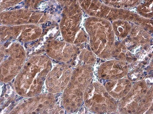 p70 S6 Kinase Antibody in Immunohistochemistry (Paraffin) (IHC (P))