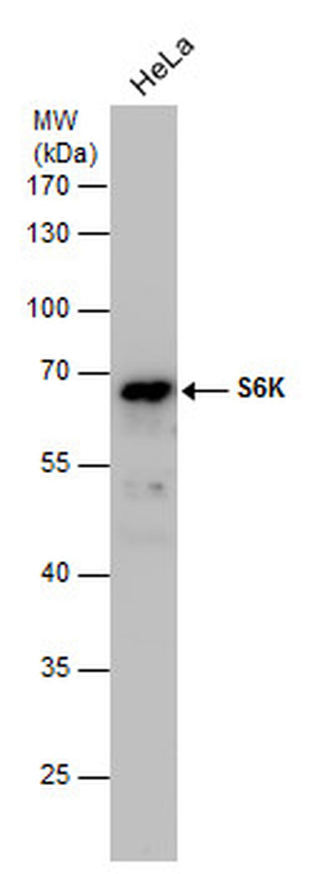 p70 S6 Kinase Antibody in Western Blot (WB)