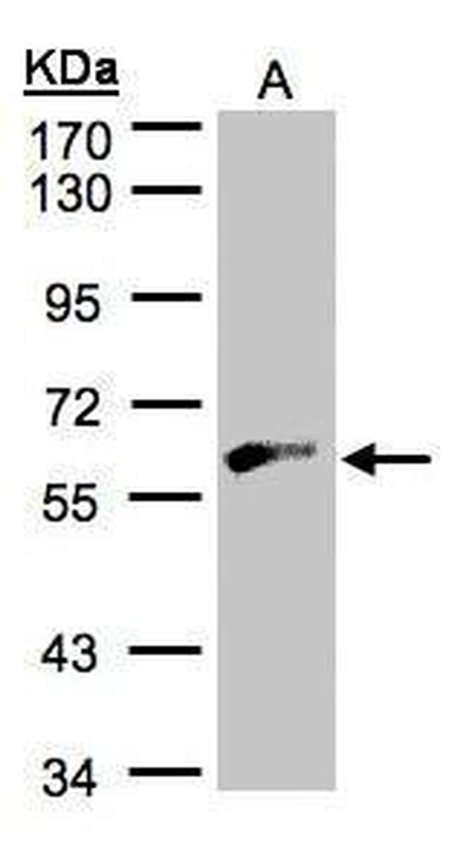 GK2 Antibody in Western Blot (WB)