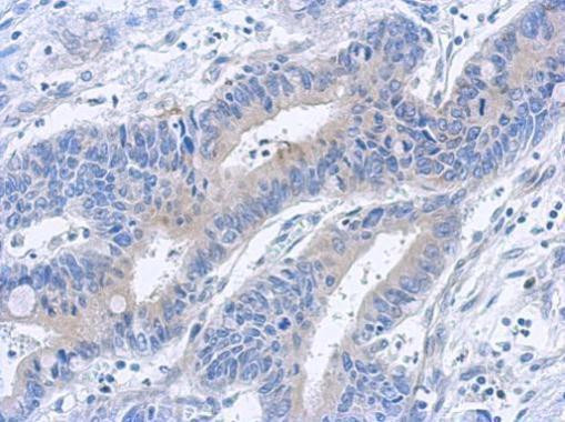 TAB1 Antibody in Immunohistochemistry (Paraffin) (IHC (P))