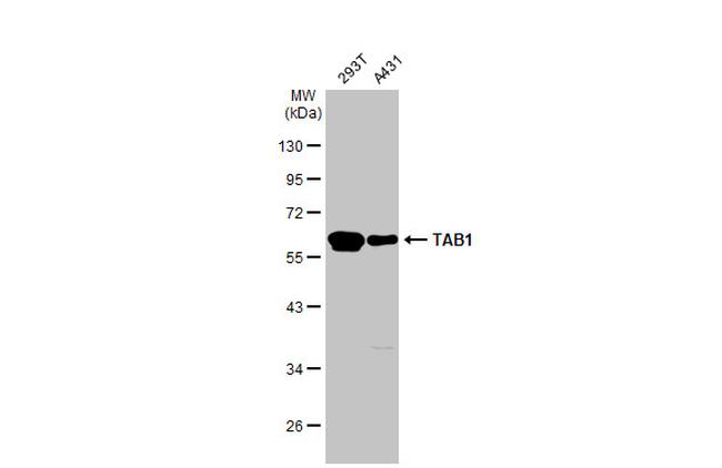 TAB1 Antibody in Western Blot (WB)