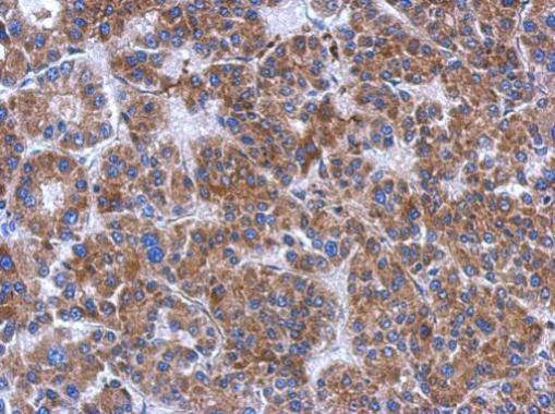 FN3K Antibody in Immunohistochemistry (Paraffin) (IHC (P))