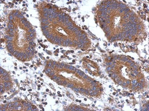 STK16 Antibody in Immunohistochemistry (Paraffin) (IHC (P))