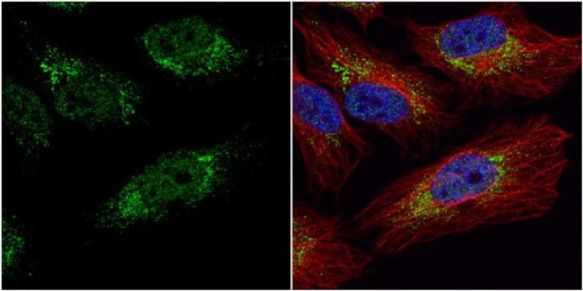 PGK1 Antibody in Immunocytochemistry (ICC/IF)