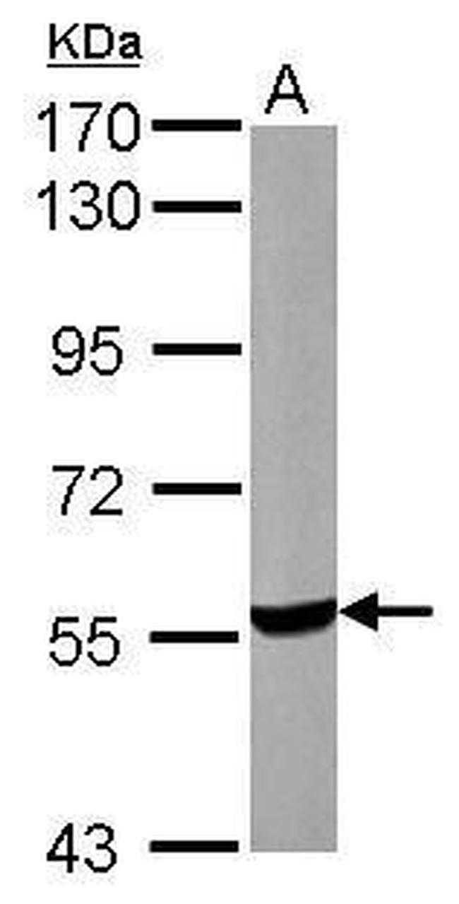 UGP2 Antibody in Western Blot (WB)