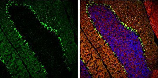 PKC gamma Antibody in Immunohistochemistry (Frozen) (IHC (F))