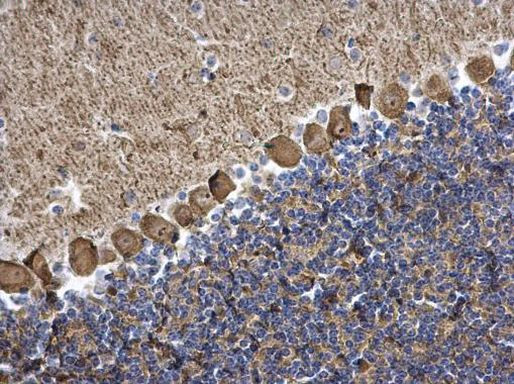 PKC gamma Antibody in Immunohistochemistry (Paraffin) (IHC (P))