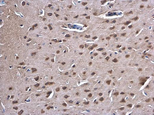 PKC gamma Antibody in Immunohistochemistry (Paraffin) (IHC (P))