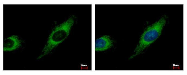 TBRG4 Antibody in Immunocytochemistry (ICC/IF)