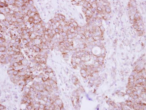 TBRG4 Antibody in Immunohistochemistry (Paraffin) (IHC (P))