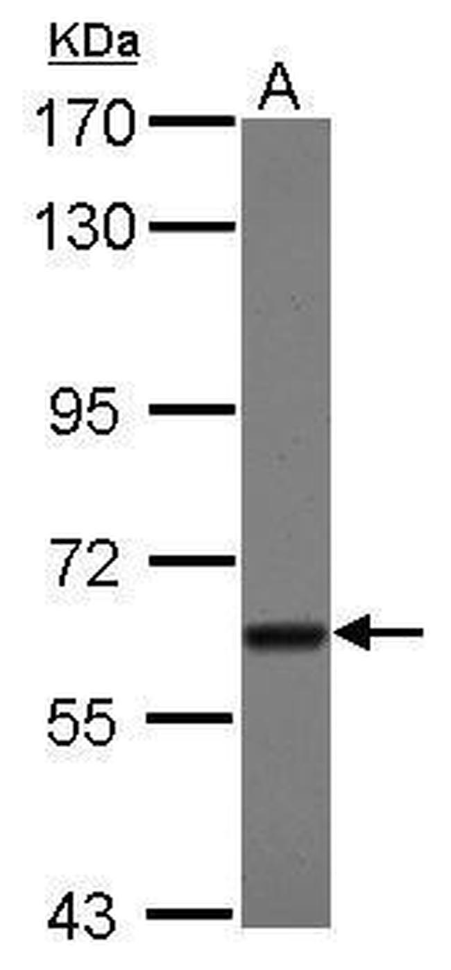 TBRG4 Antibody in Western Blot (WB)