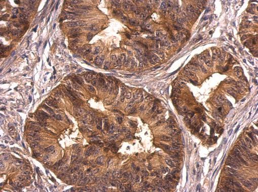 CrkL Antibody in Immunohistochemistry (Paraffin) (IHC (P))