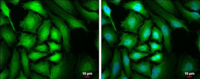 CrkL Antibody in Immunocytochemistry (ICC/IF)