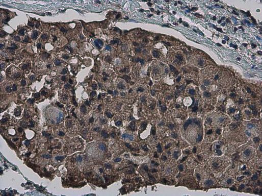 CrkL Antibody in Immunohistochemistry (Paraffin) (IHC (P))