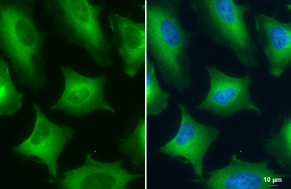 PKM2 Antibody in Immunocytochemistry (ICC/IF)