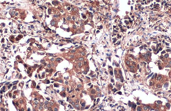 PKM2 Antibody in Immunohistochemistry (Paraffin) (IHC (P))