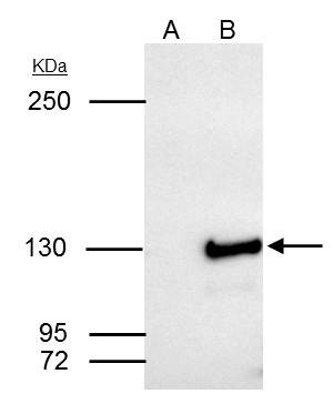 SART3 Antibody in Immunoprecipitation (IP)