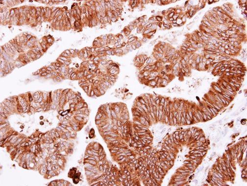 SCRIB Antibody in Immunohistochemistry (Paraffin) (IHC (P))