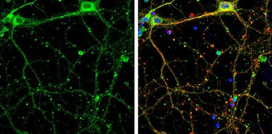 SHANK1 Antibody in Immunocytochemistry (ICC/IF)