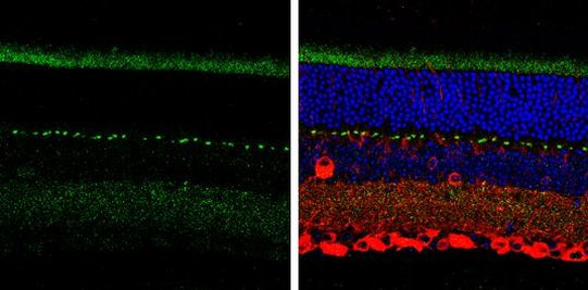 SHANK1 Antibody in Immunohistochemistry (Paraffin) (IHC (P))