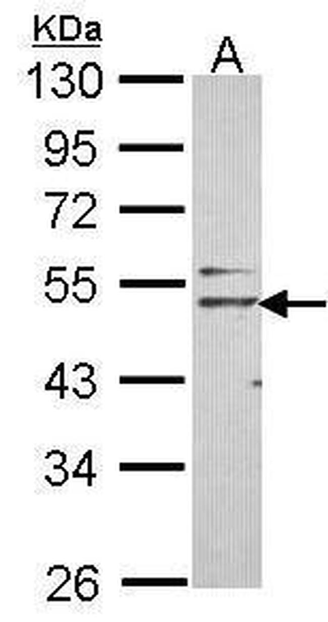 Nogo Receptor Antibody in Western Blot (WB)