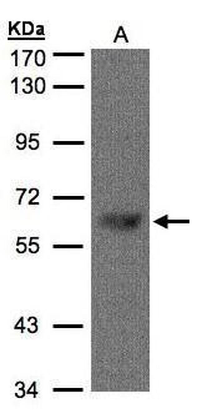 TBL1X Antibody in Western Blot (WB)