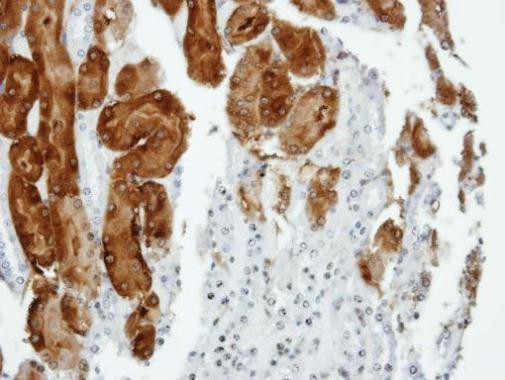 Anillin Antibody in Immunohistochemistry (Paraffin) (IHC (P))