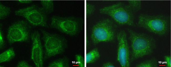 PFKFB4 Antibody in Immunocytochemistry (ICC/IF)