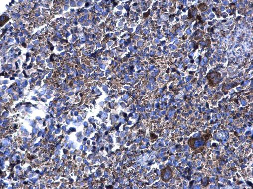 PFKFB4 Antibody in Immunohistochemistry (Paraffin) (IHC (P))