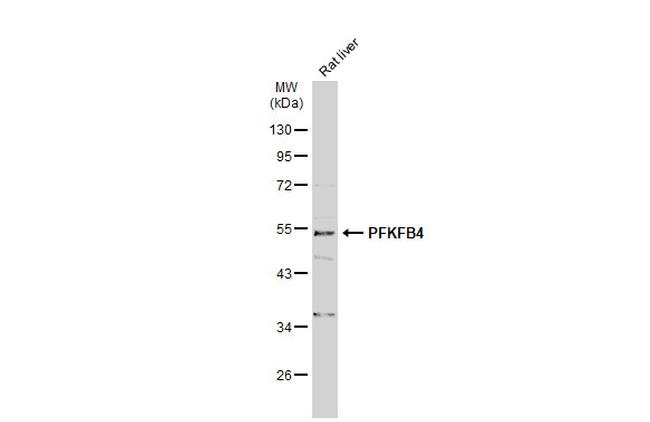 PFKFB4 Antibody in Western Blot (WB)