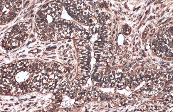 c-Raf Antibody in Immunohistochemistry (Paraffin) (IHC (P))