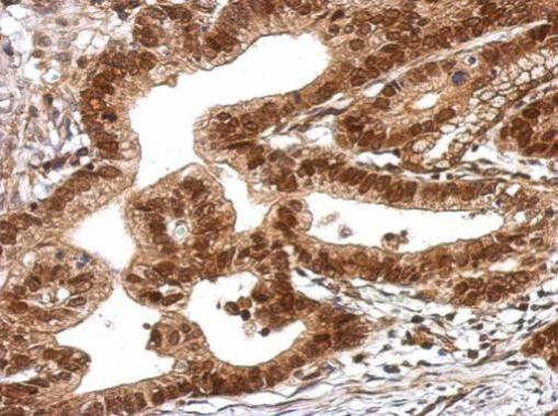 TRIM27 Antibody in Immunohistochemistry (Paraffin) (IHC (P))